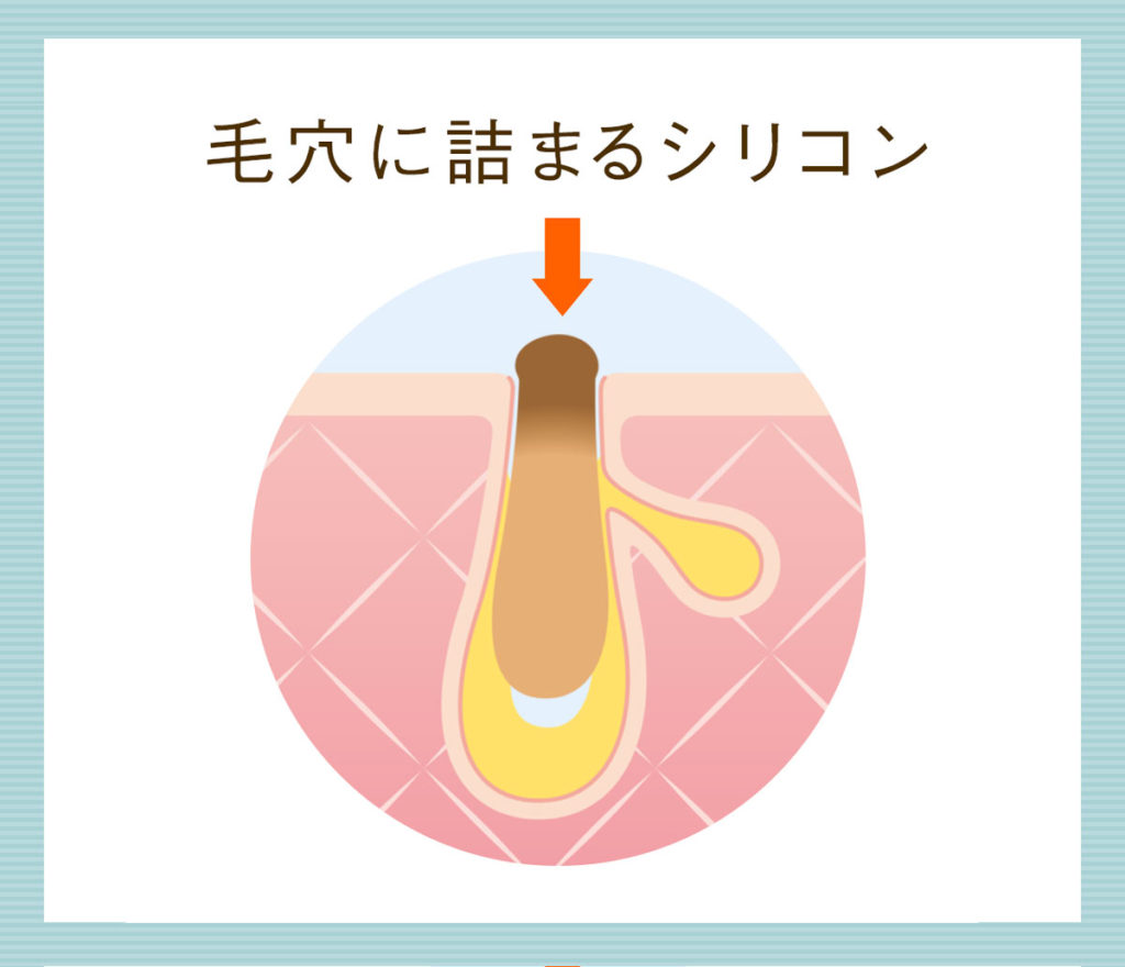 毛穴詰まりは肌断食の失敗の原因
